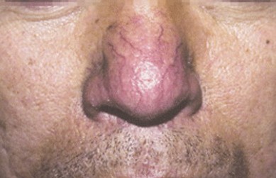 ʳע